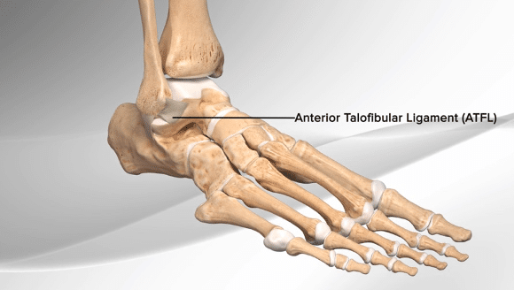 Ankle sprain diagram image